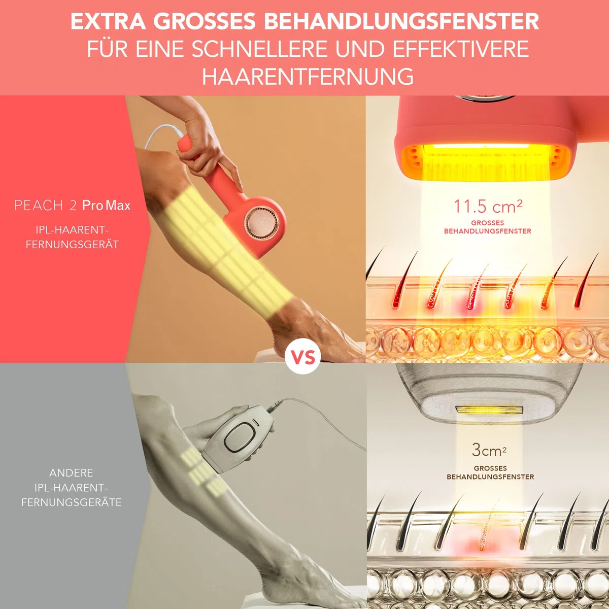 FOREO PEACH 2 Pro Max IPL-Haarentfernungsgerät - Beauty & Pflege
